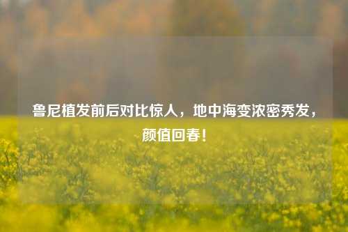 鲁尼植发前后对比惊人,地中海变浓密秀发,颜值回春!